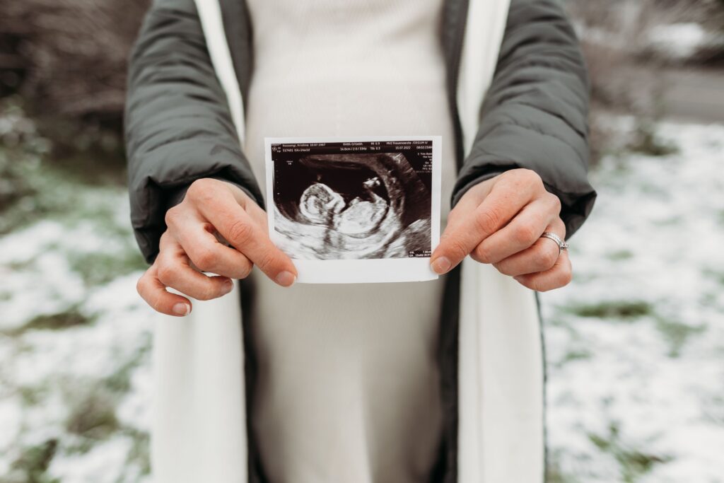 ultraschallbild wird in die kamera gehalten bei babybauchshooting